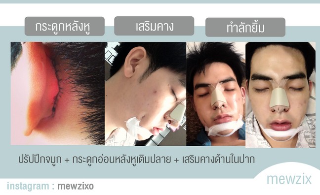 ศัลยกรรม